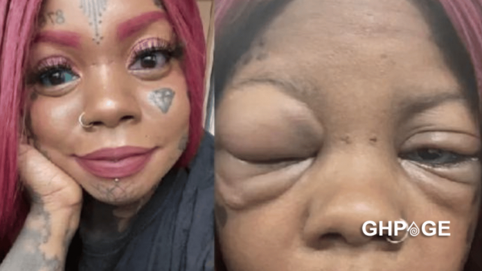 Mother going blind after tattooing her eyeballs blue and purple to copy an influencer