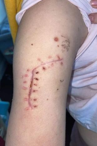Police said Cynthi was lucky to escape with her life