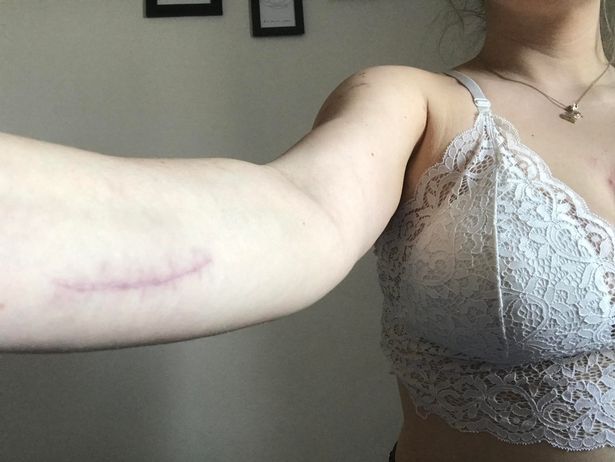 Cynthi has been left with scars all over her body