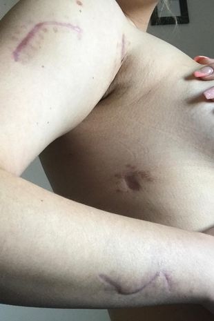 Cynthi was stabbed 11 times across the face and body