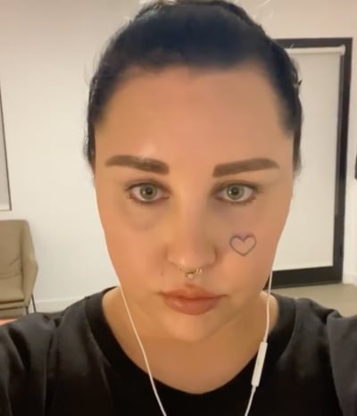 Amanda Bynes' Tattoo Removal Pic