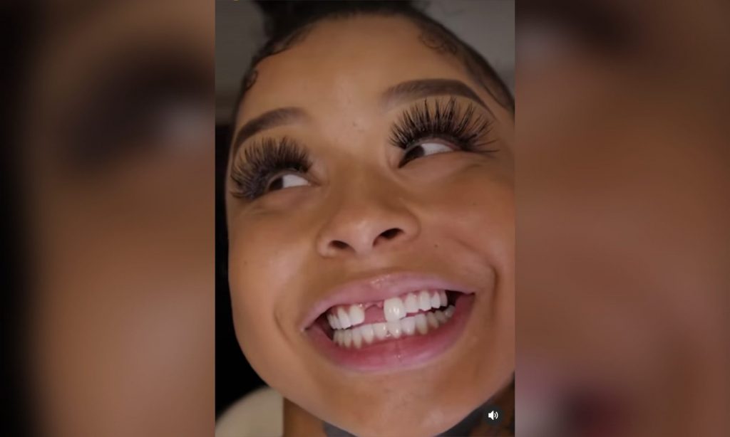 Chrisean Rock Replaces Her Missing Tooth Then Says She Wants A Gap