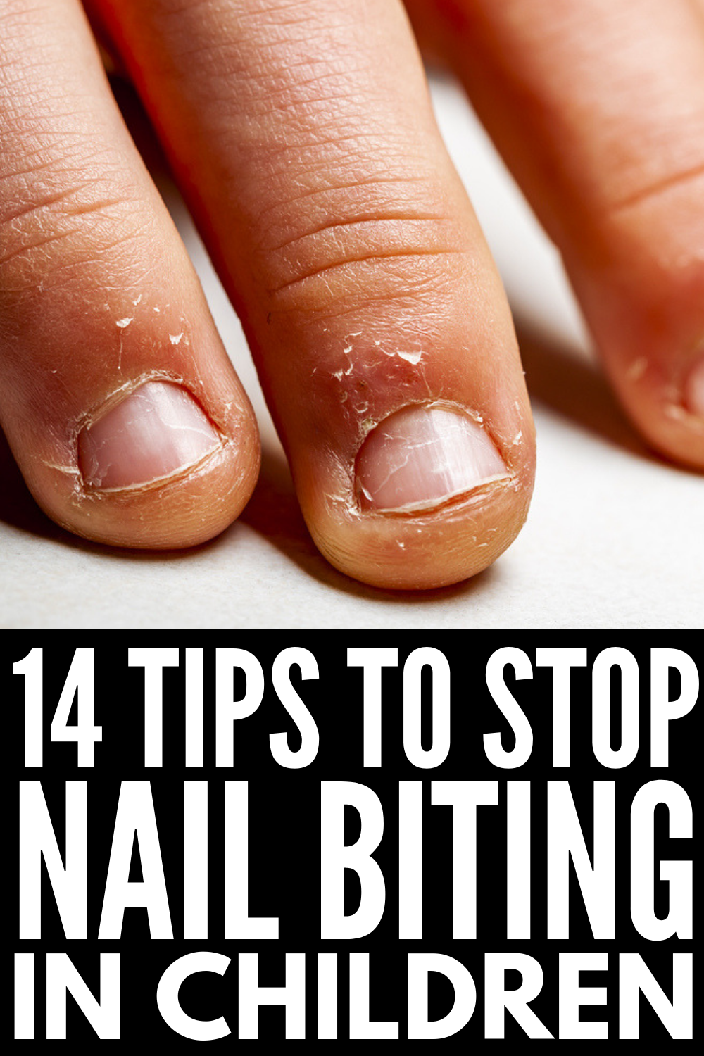 7 tips to stop biting your nails – 