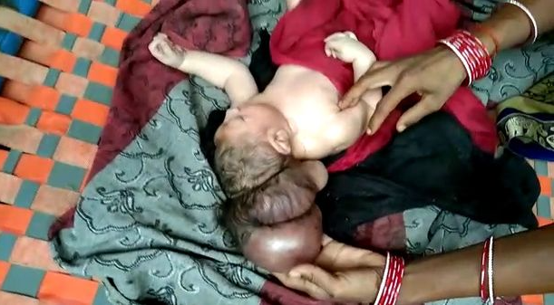 Three-headed baby hailed as incarnation of God as pilgrims travel long distances to pay homage