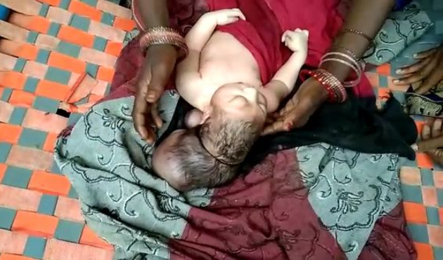 Three-headed baby hailed as incarnation of God as pilgrims travel long distances to pay homage