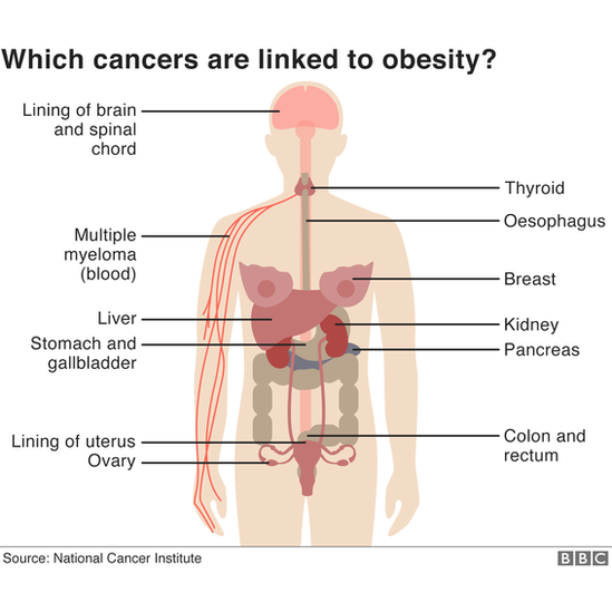 Which cancers are linked to obesity?