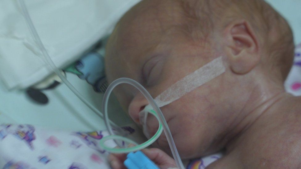 Ukraine invasion: Premature babies struggling for life in bombed cities Ukraine invasion: Premature babies struggling for life in bombed cities
