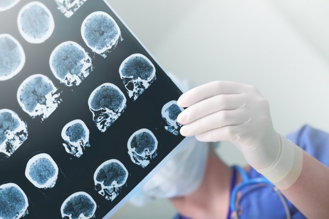Online counseling platform boosts healthy living in stroke survivors, study finds