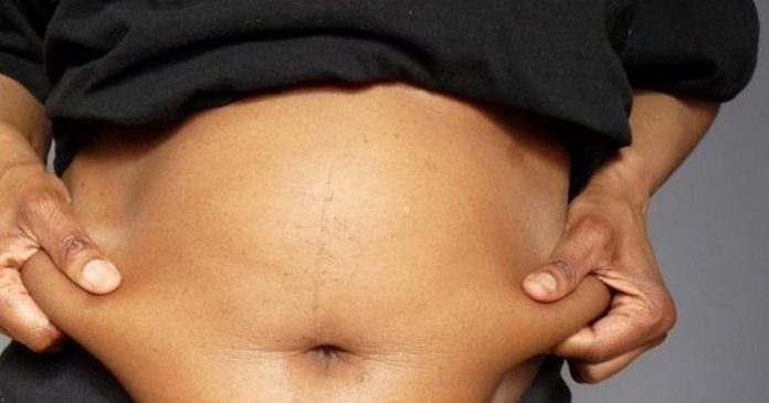 belly fat