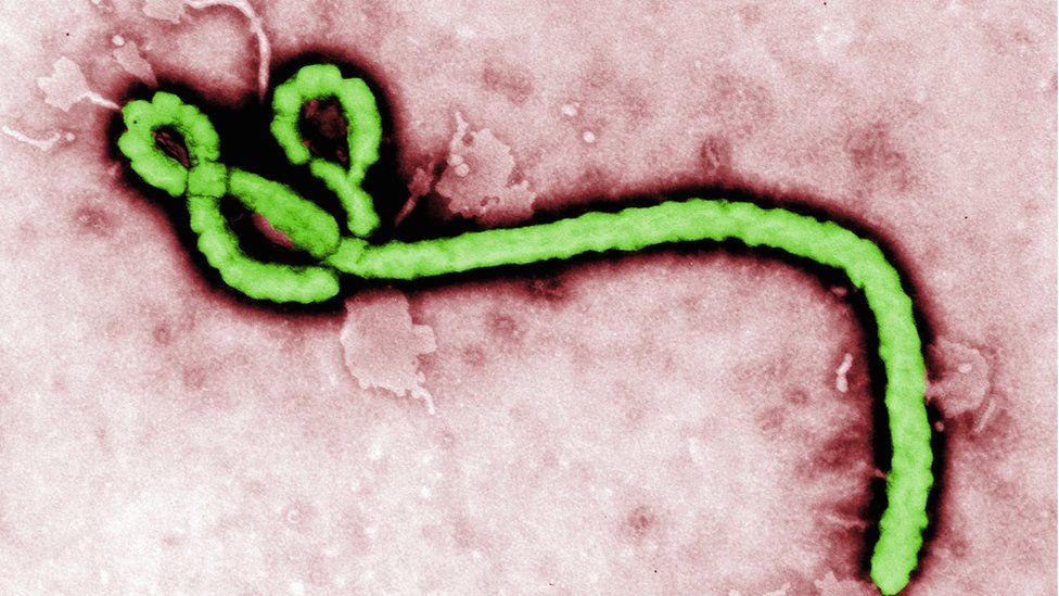 Transmission electron micrograph (TEM) of an Ebola virus virion - stock photo