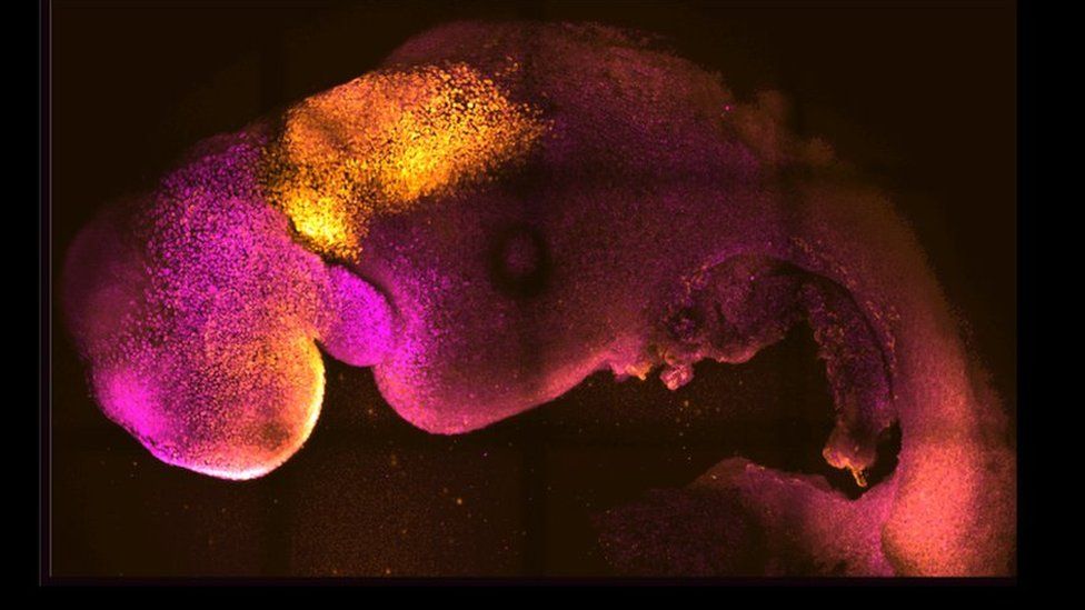 Natural and synthetic embryos side by side show comparable brain and heart formation.