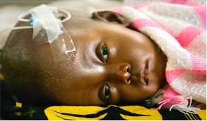 Late prodromal signs of malaria precipitates its transition to cerebral malaria
