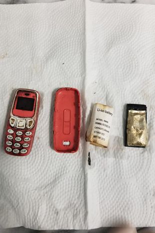 The phone parts after they were removed from his stomach