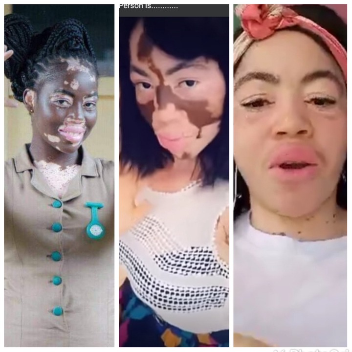 She didn't bleach; See How A Dark And Beautiful Ghanaian Nurse Became White (Photos)