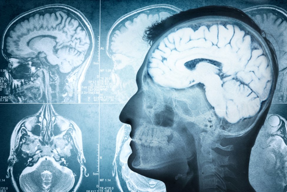 Brain may generate memories of life as humans die, study finds