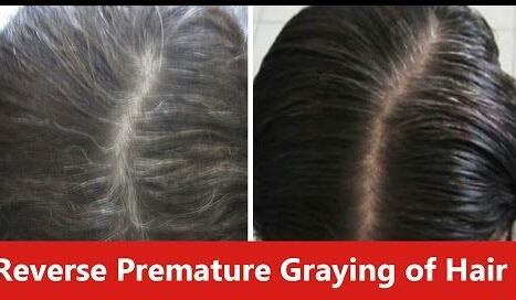 5 Home Finest Remedies To Get Rid Of Grey Hair Naturally 