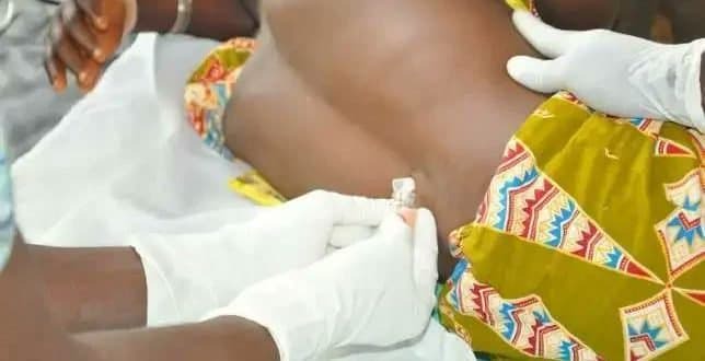 Upper West Region sees CSM cases surge to 173, death toll hits 16