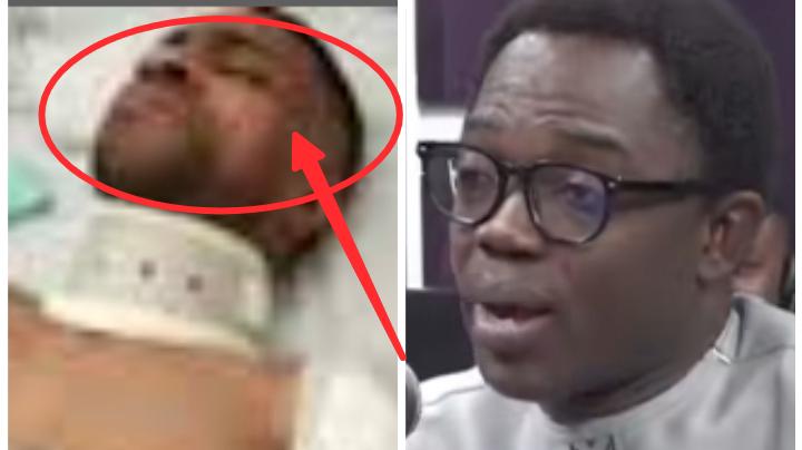 I Shed Tears After Seeing Kofi Adoma’s Face