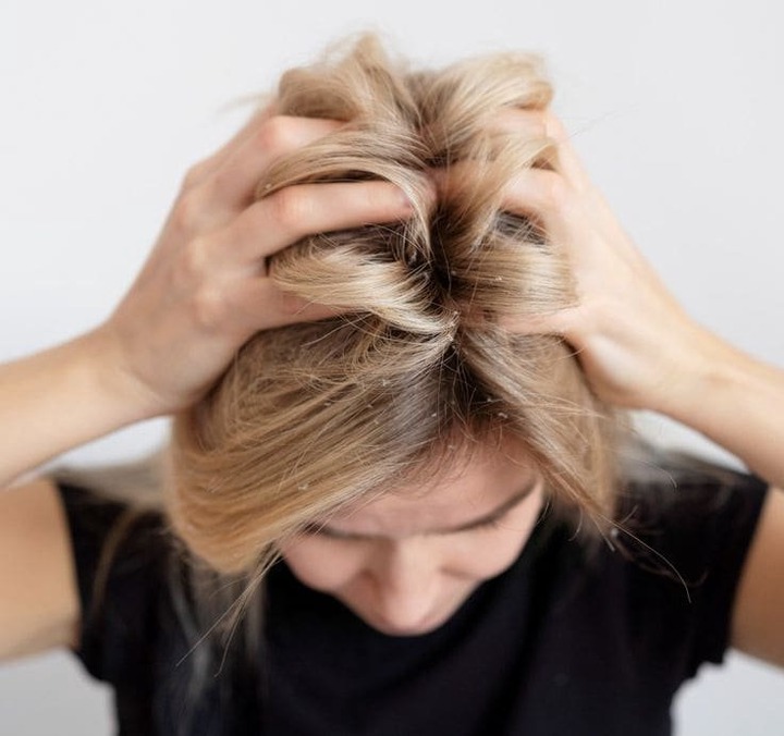 10 home remedies to eliminate hair lice