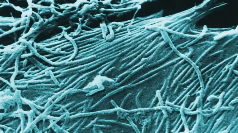 Uganda discharges Ebola patients – MyJoyOnline