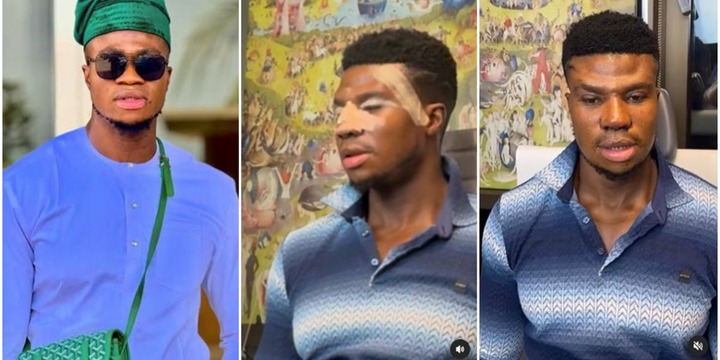 “The doctor forget to work on you forehead” – Zicsaloma stirs buzz as he flaunts new look after nose surgery