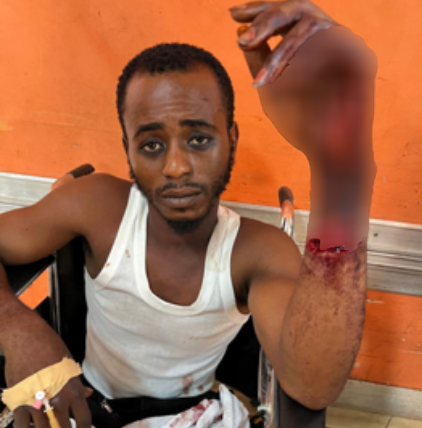 Two Hospitalized In Rival Groups Brawl