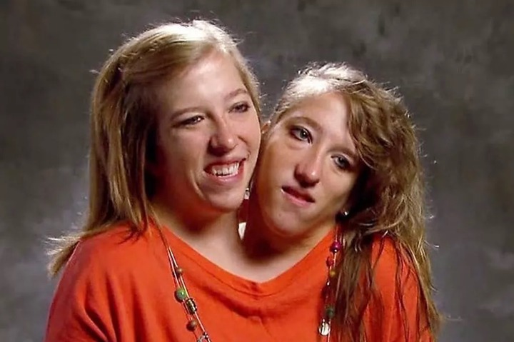 Conjoined twins Abby and Brittany Hensel now – secret wedding, husband and baby rumours