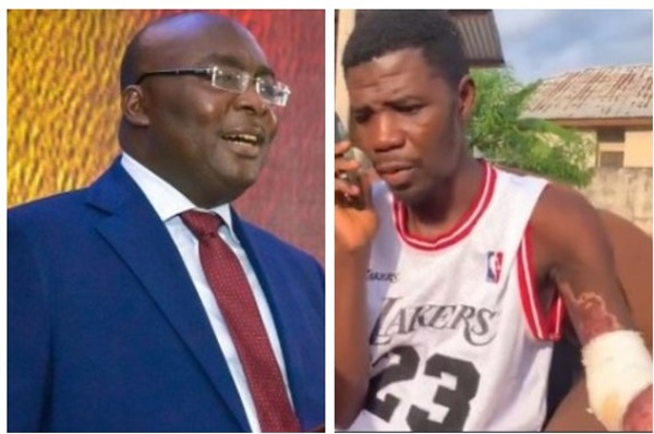 Bawumia gifts GH₵100,000 to dedicated NPP member who suffered near-fatal accident