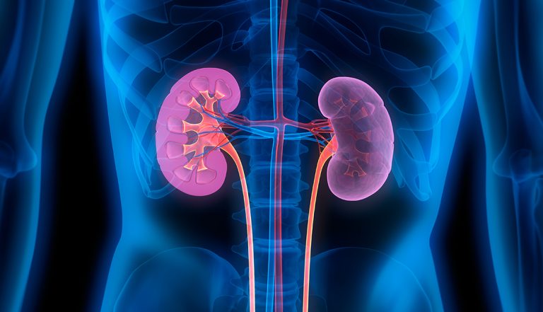 Ghanaians urged to prioritise kidney health to prevent diseases 
