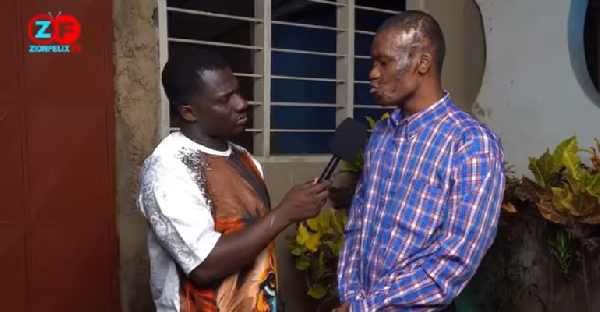 ‘She poured acid on me after I slept with her’