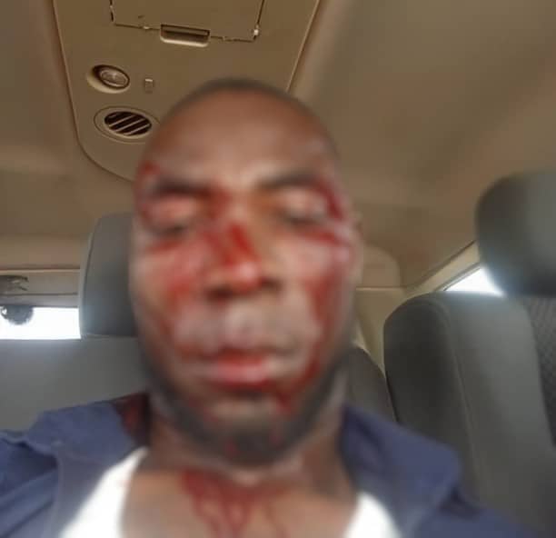 Newly elected PM assaulted after DCE nominee was rejected