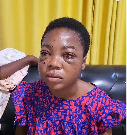 ‘Help me save my daughter’s sight’ – Mother of 16-year-old girl hit by bullet cries for support