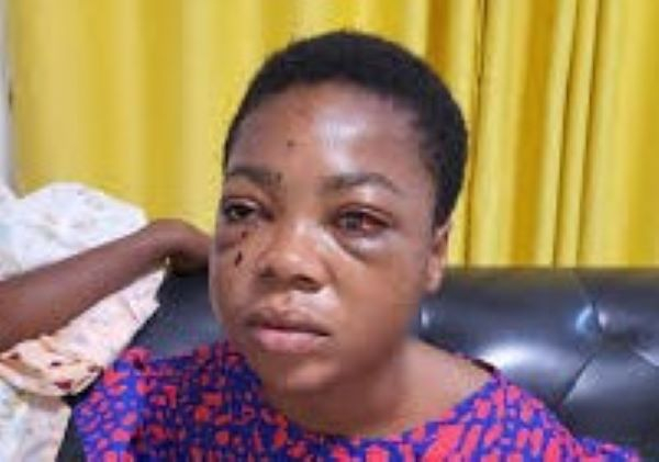 Adventist SHS student shot in eye appeals to Ken Agyapong, Ibrahim Mahama for help
