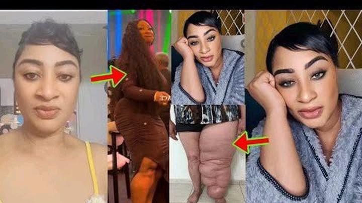 Public Concern Grows as Actress Ellen Kyei White’s Leg Condition Sparks Reactions Online