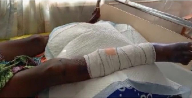 A 53-year-old woman has been beaten by his 25-year-old boyfriend