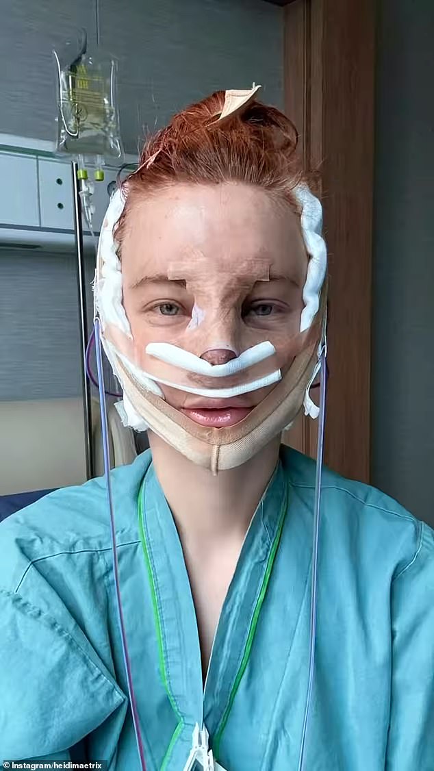 Her full facelift and rhinoplasty, which lasted eight to 10 hours, were valued at $28,000
