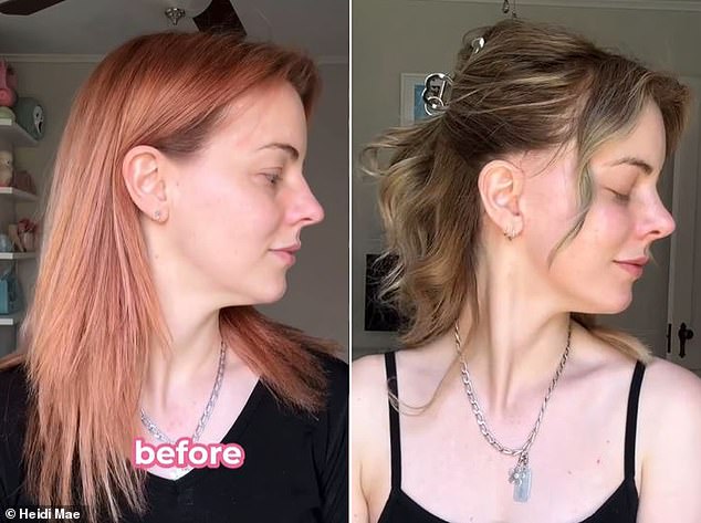 Before and after: Heidi, pictured here ahead of her surgery and eight weeks post-op, tells haters she wanted the facelift for herself