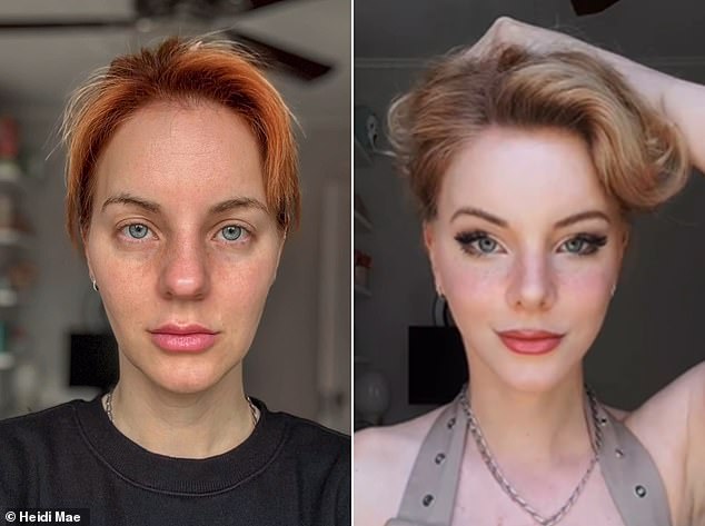 Before and after: Heidi is pictured before her rhinoplasty and facelift and 26 days after. Speaking to the Daily Mail the influencer said she had no regrets getting the procedures at 36