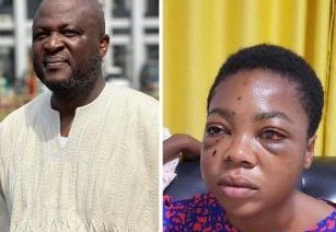Ibrahim Mahama to fly Adventist SHS student abroad for eye surgery