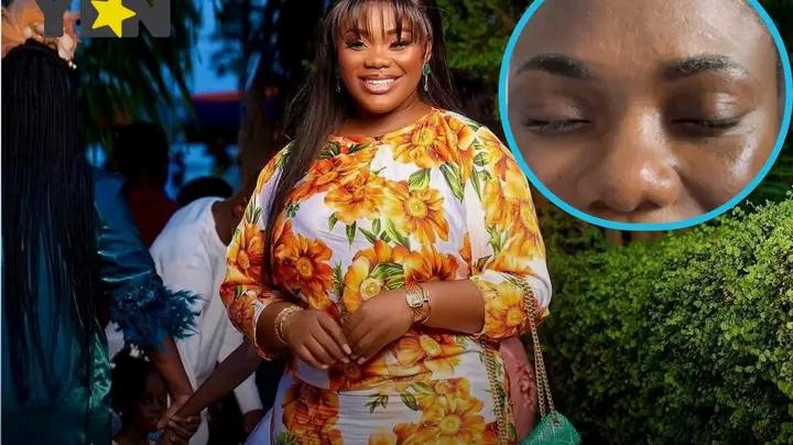 Akua GMB Stuns with Dramatic Transformation After Cosmetic Procedure