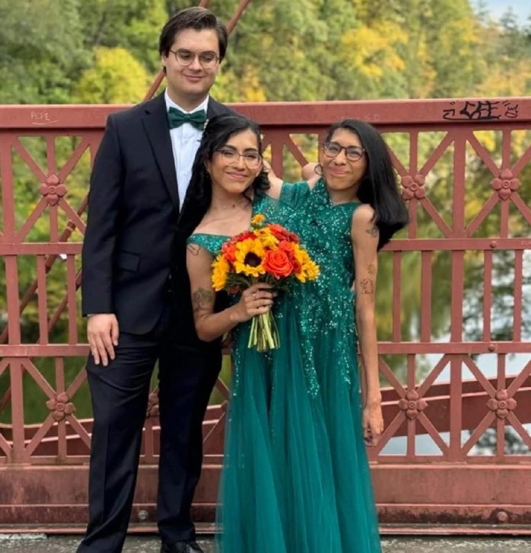 Conjoined Twin Carmen Andrade Marries Boyfriend Daniel While Sister Lupita Remains Single