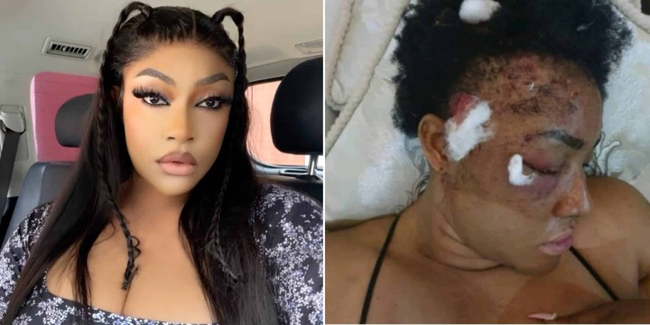 ‘I’m Still Carrying Bullets In My Head’ – Angela Okorie Shares Struggle After 2019 Assassination Attempt