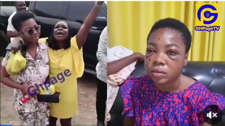 Beautiful scenes as Suzzy Pinamang returns home after a successful Eye surgery[Video]