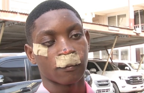 ‘My son is traumatised, fighting to heal’